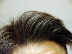 薄毛予防の最大のポイントは頭皮の環境を最善に保つこと